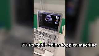 US15 Plus 2D ポータブル カラー ドップラー マシン