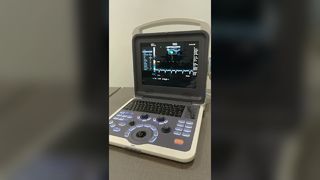 BR-US22 超音波検査装置