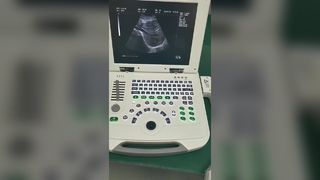 フルデジタルノート型超音波診断装置 80素子 BR-US11