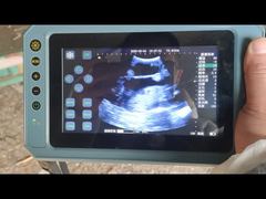 ポータブル動物用超音波スキャナー BR-VET8